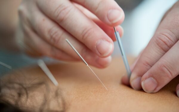 Best Acupuncture & TCM Clinics in Singapore