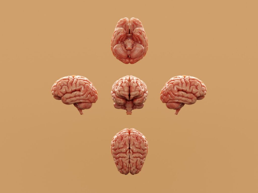 Various perspectives of a human brain are displayed.