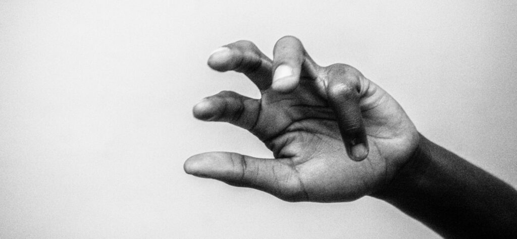 Arm and hand recovery after stroke
