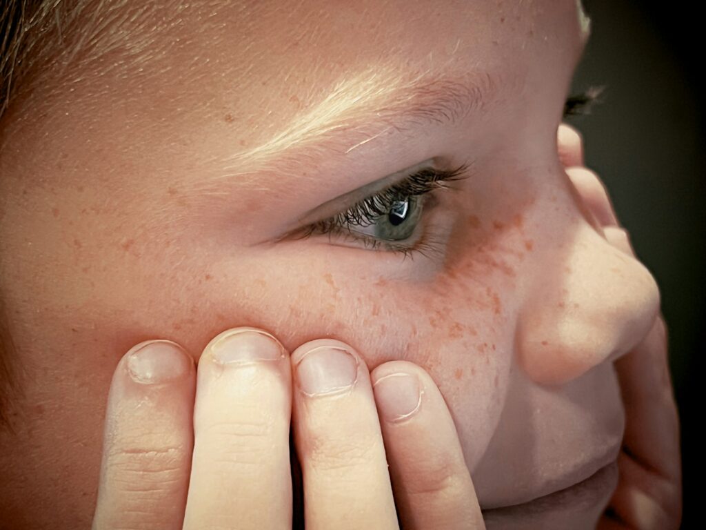 A child with a viral rash