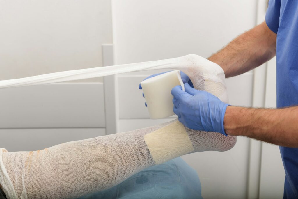 Compression garments and bandaging
