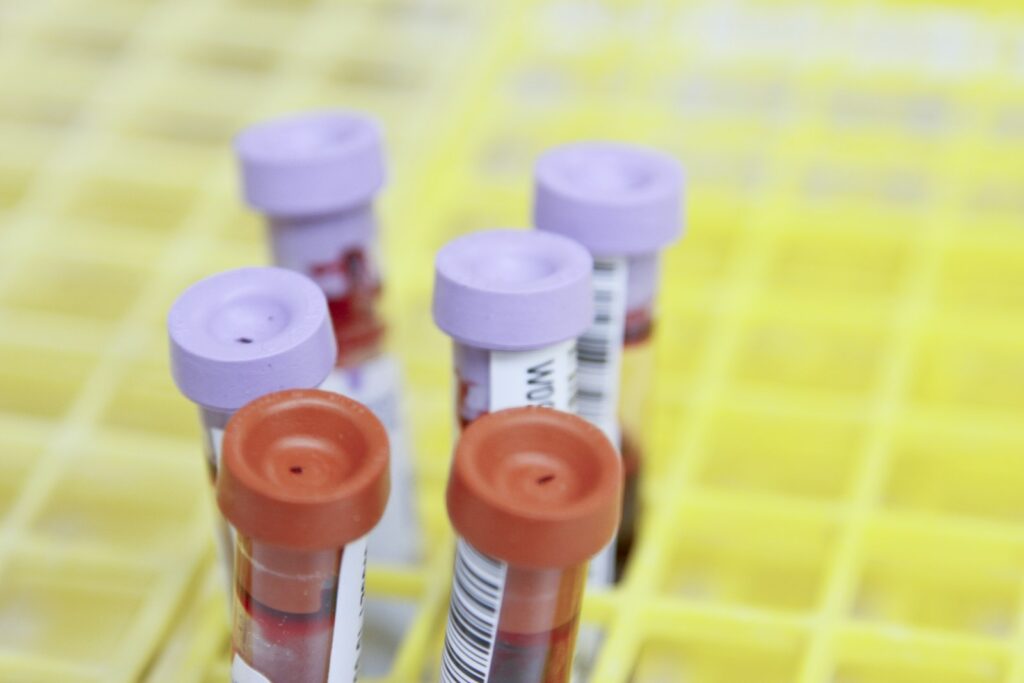 Blood sample