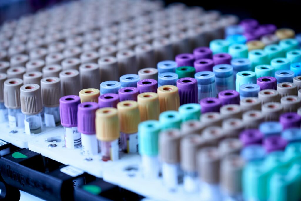 Blood test for testosterone