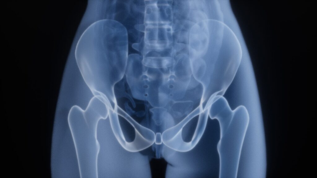 Hip joint imaging