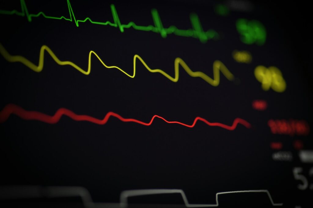 Cardiac stress test